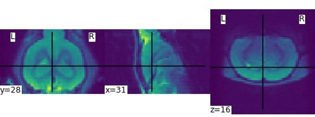 Figure 3 for Generation of Synthetic Rat Brain MRI scans with a 3D Enhanced Alpha-GAN