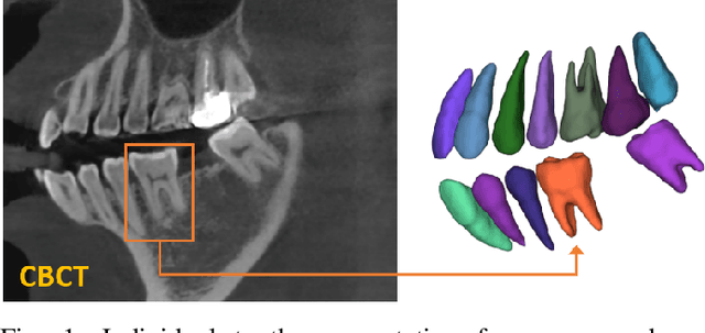 Figure 1 for Pose-Aware Instance Segmentation Framework from Cone Beam CT Images for Tooth Segmentation