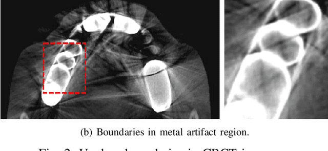 Figure 3 for Pose-Aware Instance Segmentation Framework from Cone Beam CT Images for Tooth Segmentation