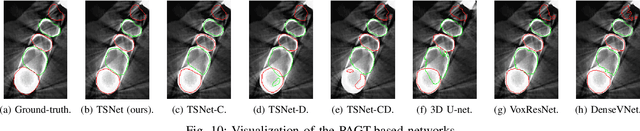 Figure 2 for Pose-Aware Instance Segmentation Framework from Cone Beam CT Images for Tooth Segmentation
