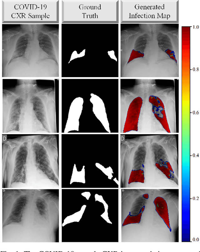 Figure 1 for COVID-19 Infection Map Generation and Detection from Chest X-Ray Images