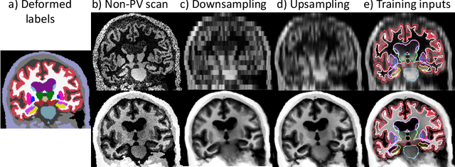 Figure 1 for Partial Volume Segmentation of Brain MRI Scans of any Resolution and Contrast