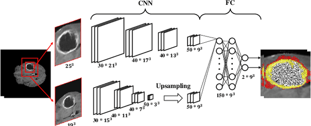 Figure 3 for Deep Learning in Computer-Aided Diagnosis and Treatment of Tumors: A Survey
