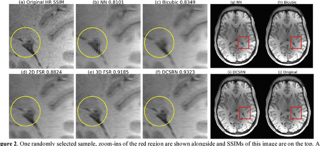 Figure 3 for Brain MRI Super Resolution Using 3D Deep Densely Connected Neural Networks