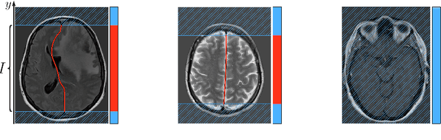 Figure 3 for Incorporating Task-Specific Structural Knowledge into CNNs for Brain Midline Shift Detection