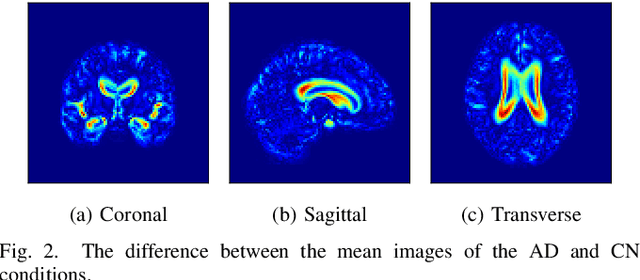 Figure 2 for Loc-VAE: Learning Structurally Localized Representation from 3D Brain MR Images for Content-Based Image Retrieval