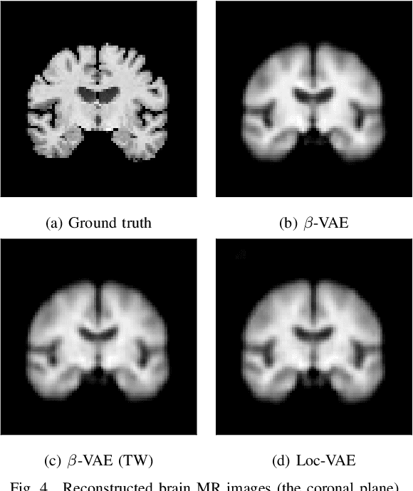 Figure 4 for Loc-VAE: Learning Structurally Localized Representation from 3D Brain MR Images for Content-Based Image Retrieval