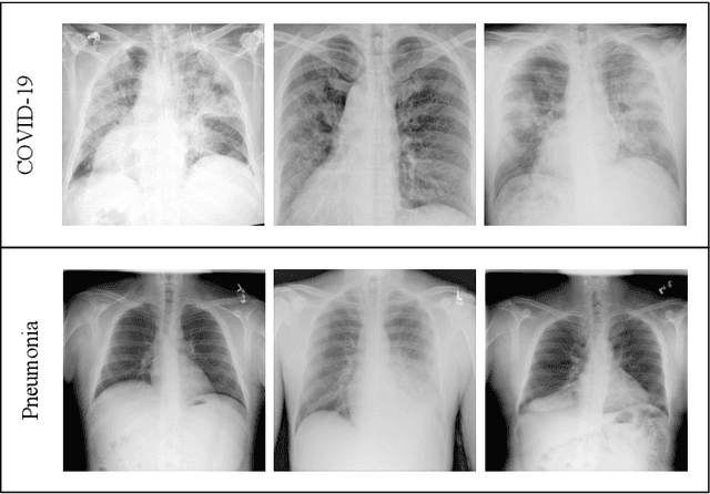 Figure 1 for Deep Learning for Screening COVID-19 using Chest X-Ray Images