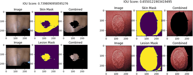 Figure 3 for AI Progress in Skin Lesion Analysis