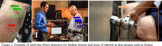 Figure 4 for AI Progress in Skin Lesion Analysis