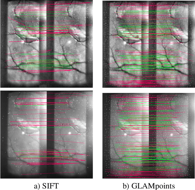 Figure 1 for GLAMpoints: Greedily Learned Accurate Match points