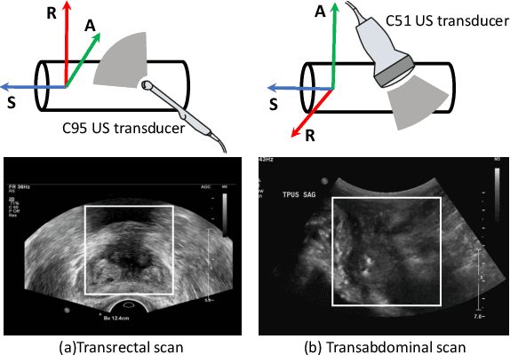 Figure 1 for Transducer Adaptive Ultrasound Volume Reconstruction