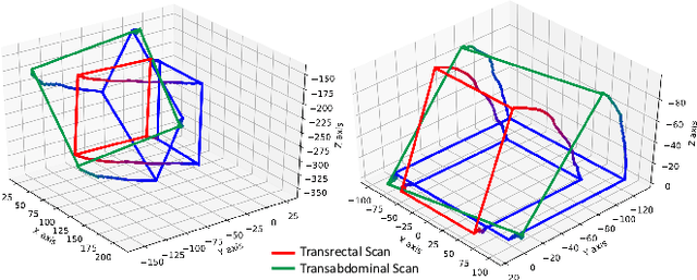 Figure 3 for Transducer Adaptive Ultrasound Volume Reconstruction
