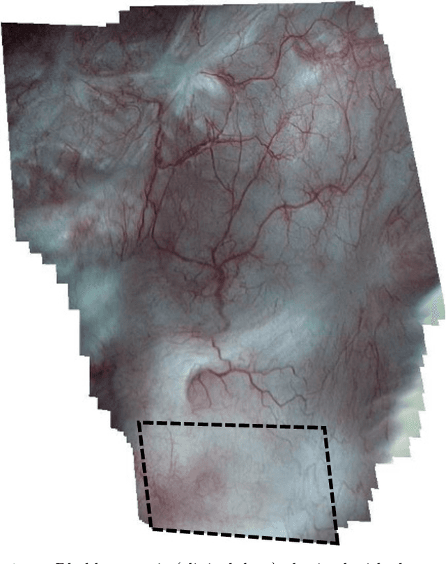 Figure 1 for Construction of extended 3D field of views of the internal bladder wall surface: a proof of concept