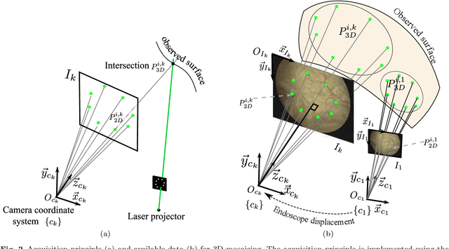 Figure 3 for Construction of extended 3D field of views of the internal bladder wall surface: a proof of concept