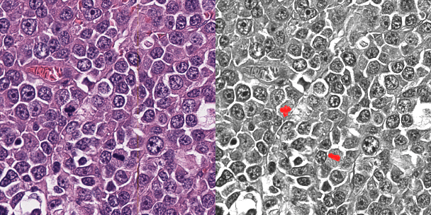 Figure 2 for OncoPetNet: A Deep Learning based AI system for mitotic figure counting on H&E stained whole slide digital images in a large veterinary diagnostic lab setting