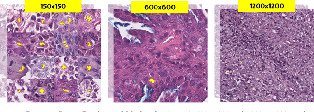 Figure 3 for OncoPetNet: A Deep Learning based AI system for mitotic figure counting on H&E stained whole slide digital images in a large veterinary diagnostic lab setting