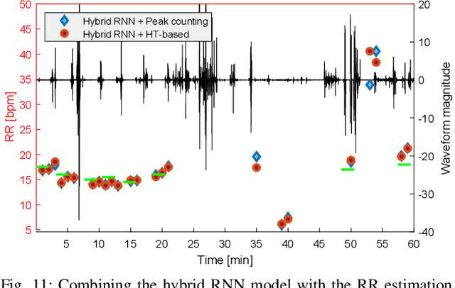 Figure 3 for An Intelligent Bed Sensor System for Non-Contact Respiratory Rate Monitoring