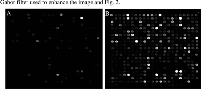 Figure 2 for Recognition of cDNA microarray image Using Feedforward artificial neural network