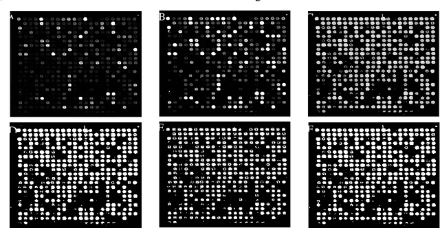 Figure 4 for Recognition of cDNA microarray image Using Feedforward artificial neural network