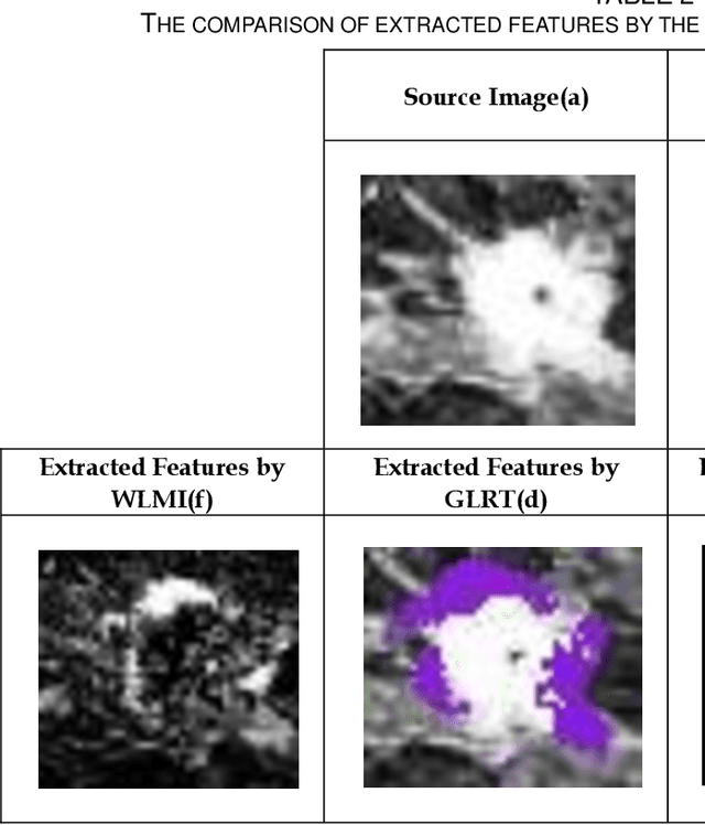 Figure 4 for A New Automatic Change Detection Frame-work Based on Region Growing and Weighted Local Mutual Information: Analysis of Breast Tumor Response to Chemotherapy in Serial MR Images