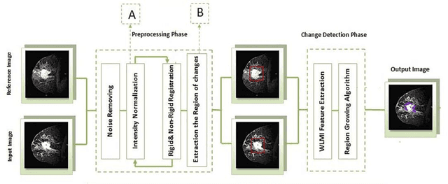 Figure 3 for A New Automatic Change Detection Frame-work Based on Region Growing and Weighted Local Mutual Information: Analysis of Breast Tumor Response to Chemotherapy in Serial MR Images