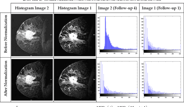 Figure 2 for A New Automatic Change Detection Frame-work Based on Region Growing and Weighted Local Mutual Information: Analysis of Breast Tumor Response to Chemotherapy in Serial MR Images