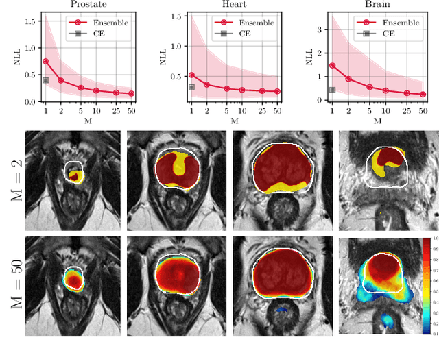 Figure 2 for Confidence Calibration and Predictive Uncertainty Estimation for Deep Medical Image Segmentation