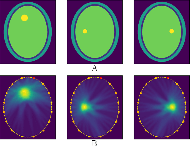 Figure 4 for Graph Attention Network For Microwave Imaging of Brain Anomaly