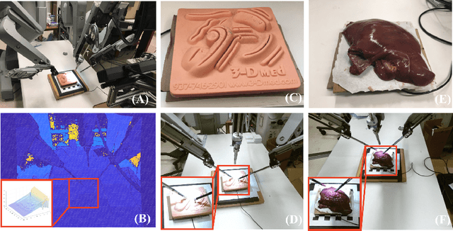 Figure 3 for Learning to See Forces: Surgical Force Prediction with RGB-Point Cloud Temporal Convolutional Networks