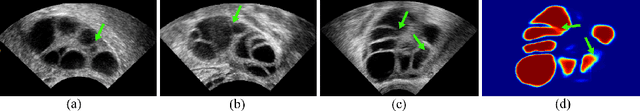 Figure 1 for Contrastive Rendering for Ultrasound Image Segmentation