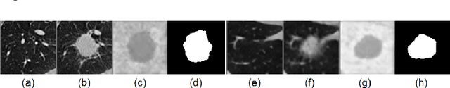 Figure 2 for Correlation via synthesis: end-to-end nodule image generation and radiogenomic map learning based on generative adversarial network