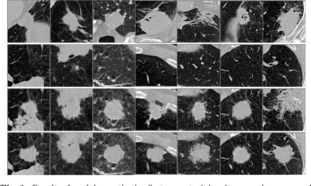 Figure 3 for Correlation via synthesis: end-to-end nodule image generation and radiogenomic map learning based on generative adversarial network