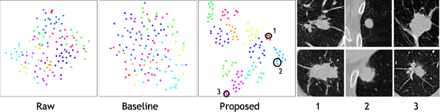 Figure 4 for Correlation via synthesis: end-to-end nodule image generation and radiogenomic map learning based on generative adversarial network