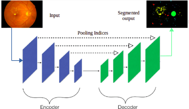 Figure 1 for Fully Convolutional Neural Network for Semantic Segmentation of Anatomical Structure and Pathologies in Colour Fundus Images Associated with Diabetic Retinopathy