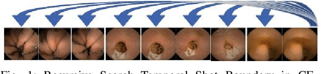 Figure 1 for Unsupervised Shot Boundary Detection for Temporal Segmentation of Long Capsule Endoscopy Videos