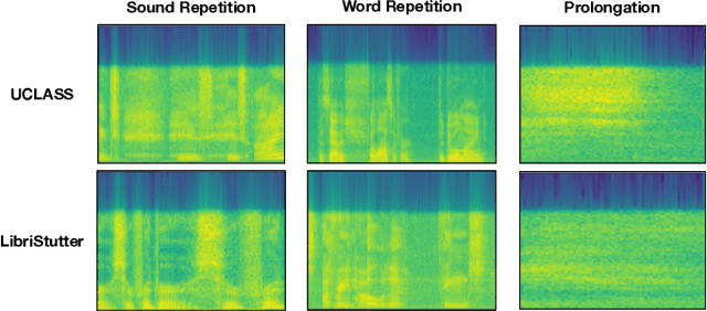 Figure 4 for FluentNet: End-to-End Detection of Speech Disfluency with Deep Learning
