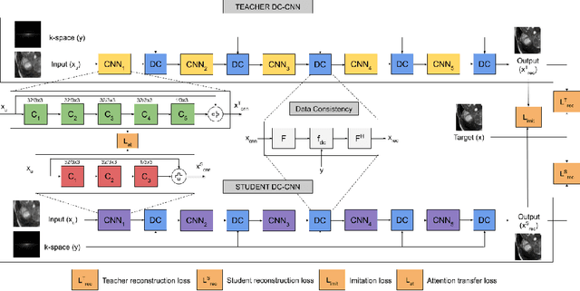 Figure 1 for KD-MRI: A knowledge distillation framework for image reconstruction and image restoration in MRI workflow