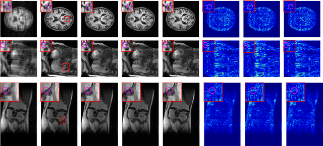 Figure 3 for KD-MRI: A knowledge distillation framework for image reconstruction and image restoration in MRI workflow