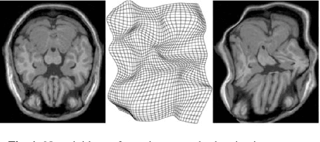 Figure 1 for Deep Convolutional Neural Network for Non-rigid Image Registration
