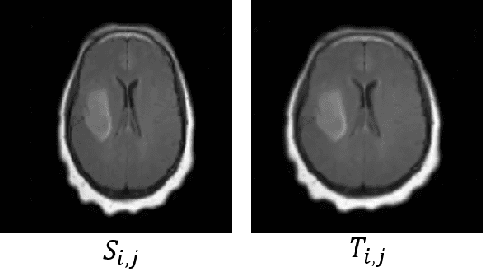 Figure 4 for Deep Convolutional Neural Network for Non-rigid Image Registration