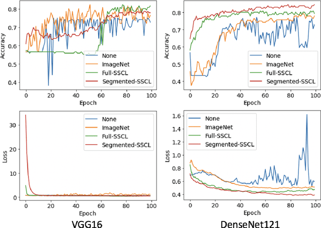 Figure 2 for Interaction of a priori Anatomic Knowledge with Self-Supervised Contrastive Learning in Cardiac Magnetic Resonance Imaging