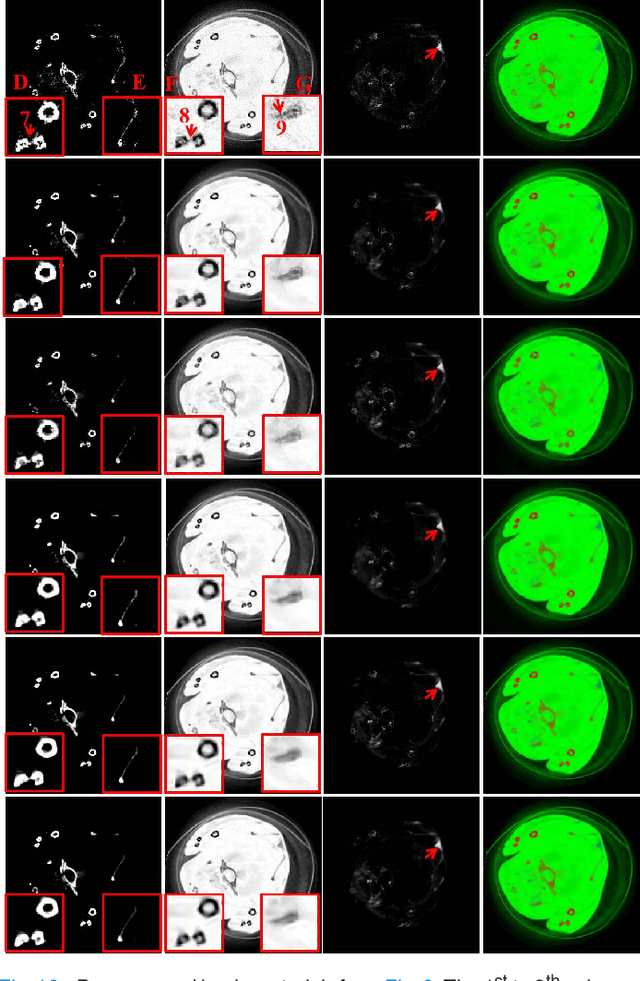 Figure 2 for Non-local Low-rank Cube-based Tensor Factorization for Spectral CT Reconstruction