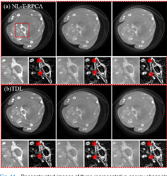 Figure 3 for Non-local Low-rank Cube-based Tensor Factorization for Spectral CT Reconstruction