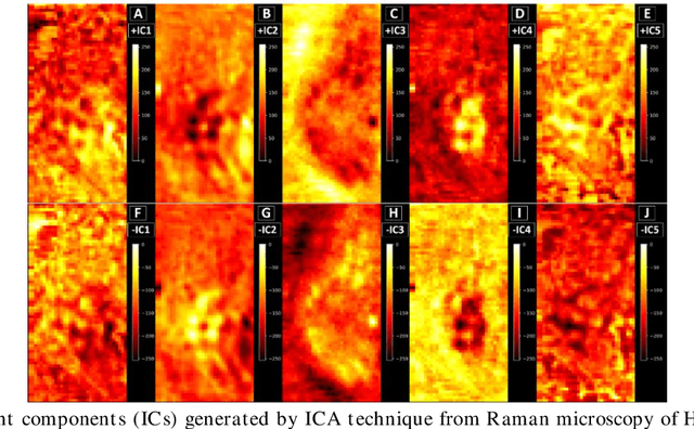 Figure 3 for Spectral unmixing of Raman microscopic images of single human cells using Independent Component Analysis