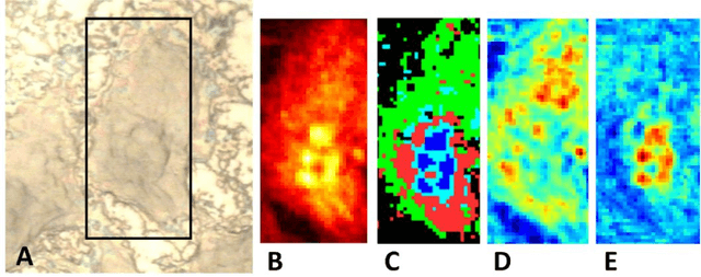 Figure 4 for Spectral unmixing of Raman microscopic images of single human cells using Independent Component Analysis