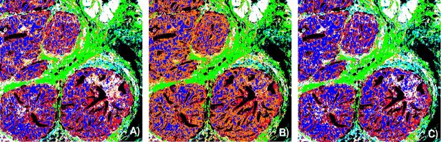 Figure 3 for Deep Neural Networks for the Correction of Mie Scattering in Fourier-Transformed Infrared Spectra of Biological Samples