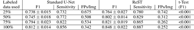 Figure 1 for Integrating Reinforcement Learning to Self Training for Pulmonary Nodule Segmentation in Chest X-rays