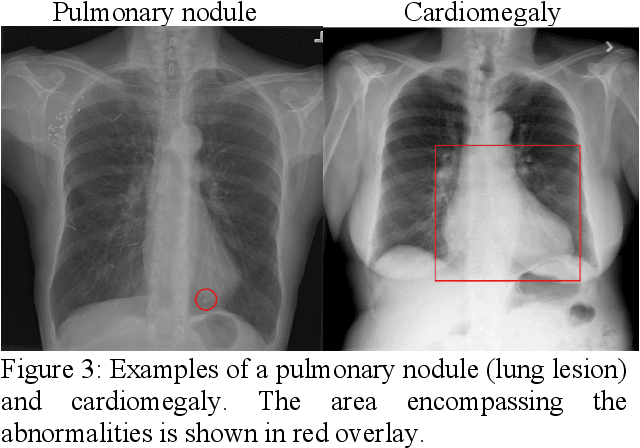 Figure 4 for Deep learning classification of chest x-ray images