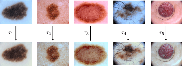 Figure 1 for Data-Driven Color Augmentation Techniques for Deep Skin Image Analysis